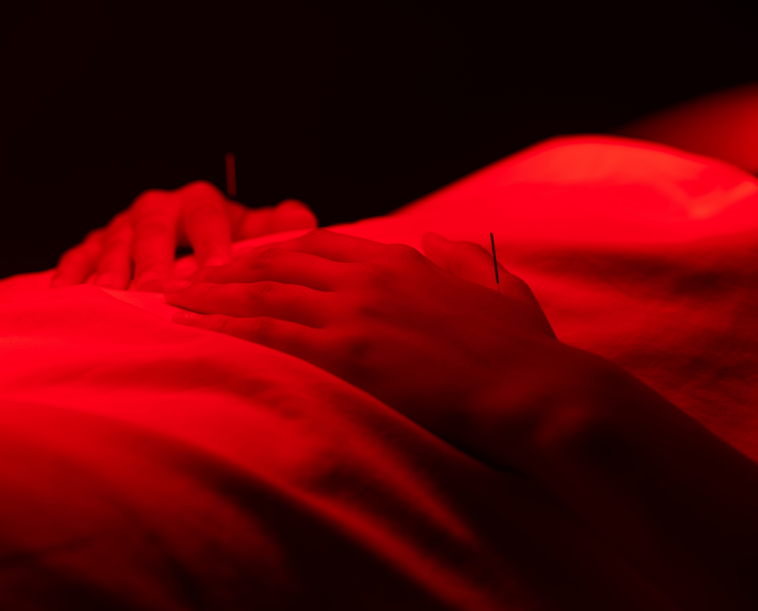 Essential ORA Method™Acupuncture