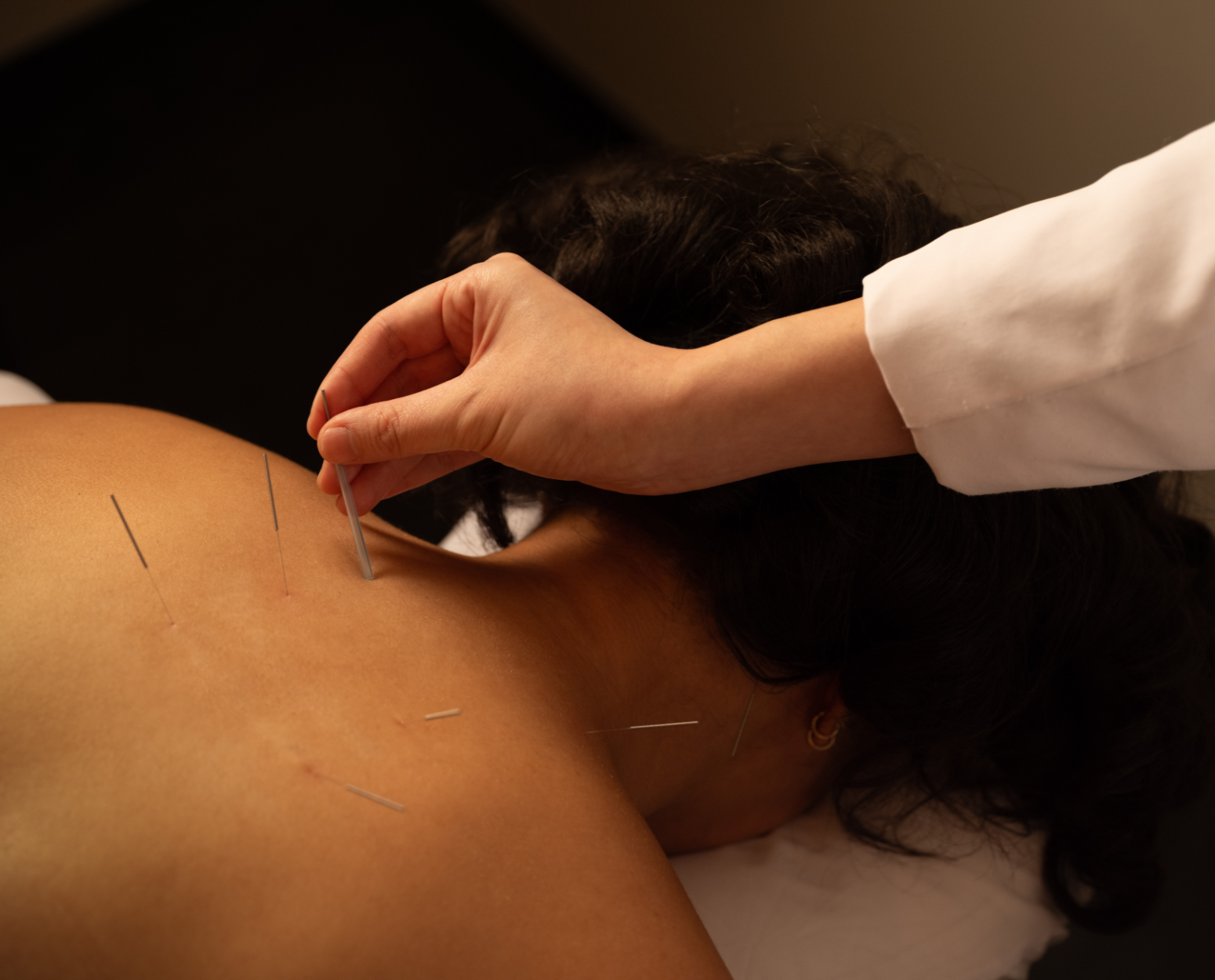 Extended ORA Method™ Acupuncture