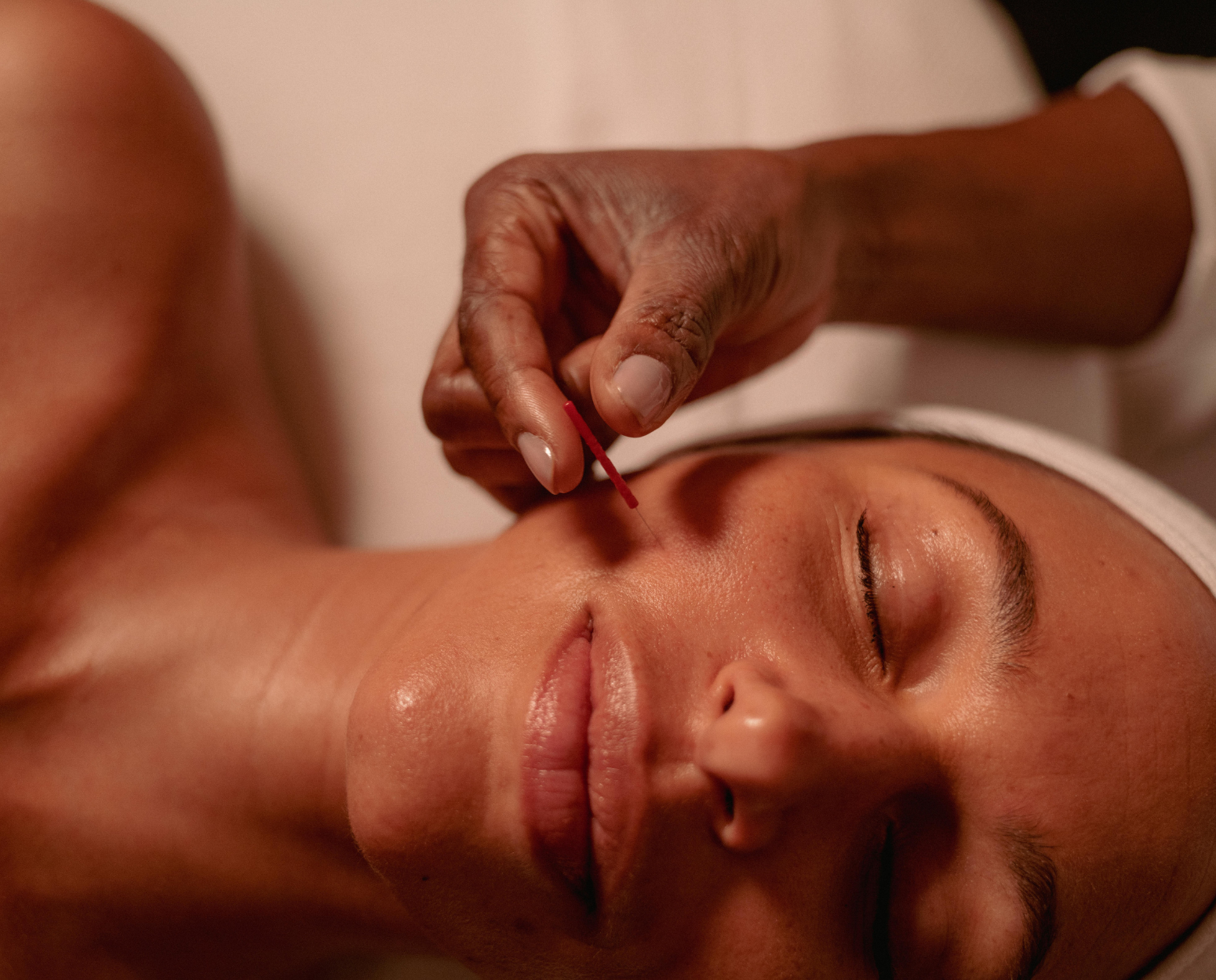 ORA Method™ Acupuncture Facial