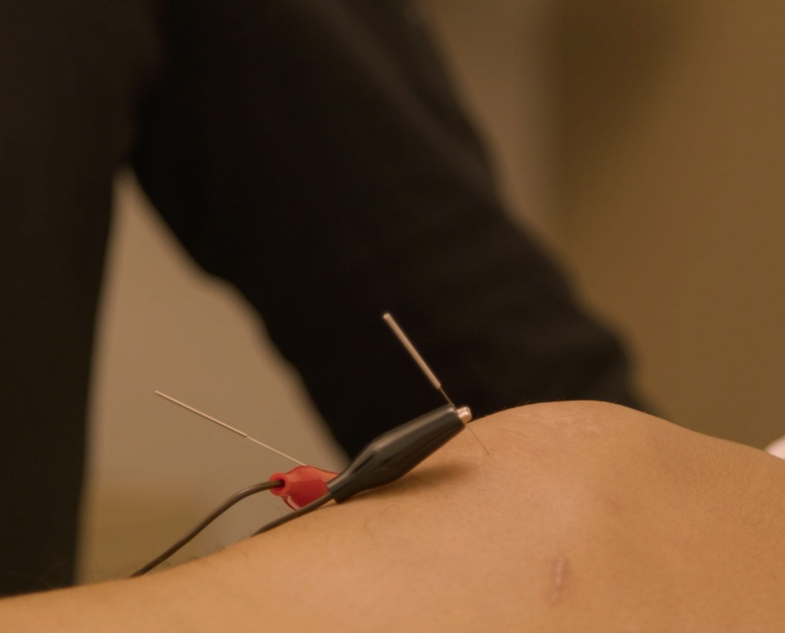 E-Stim Add-on