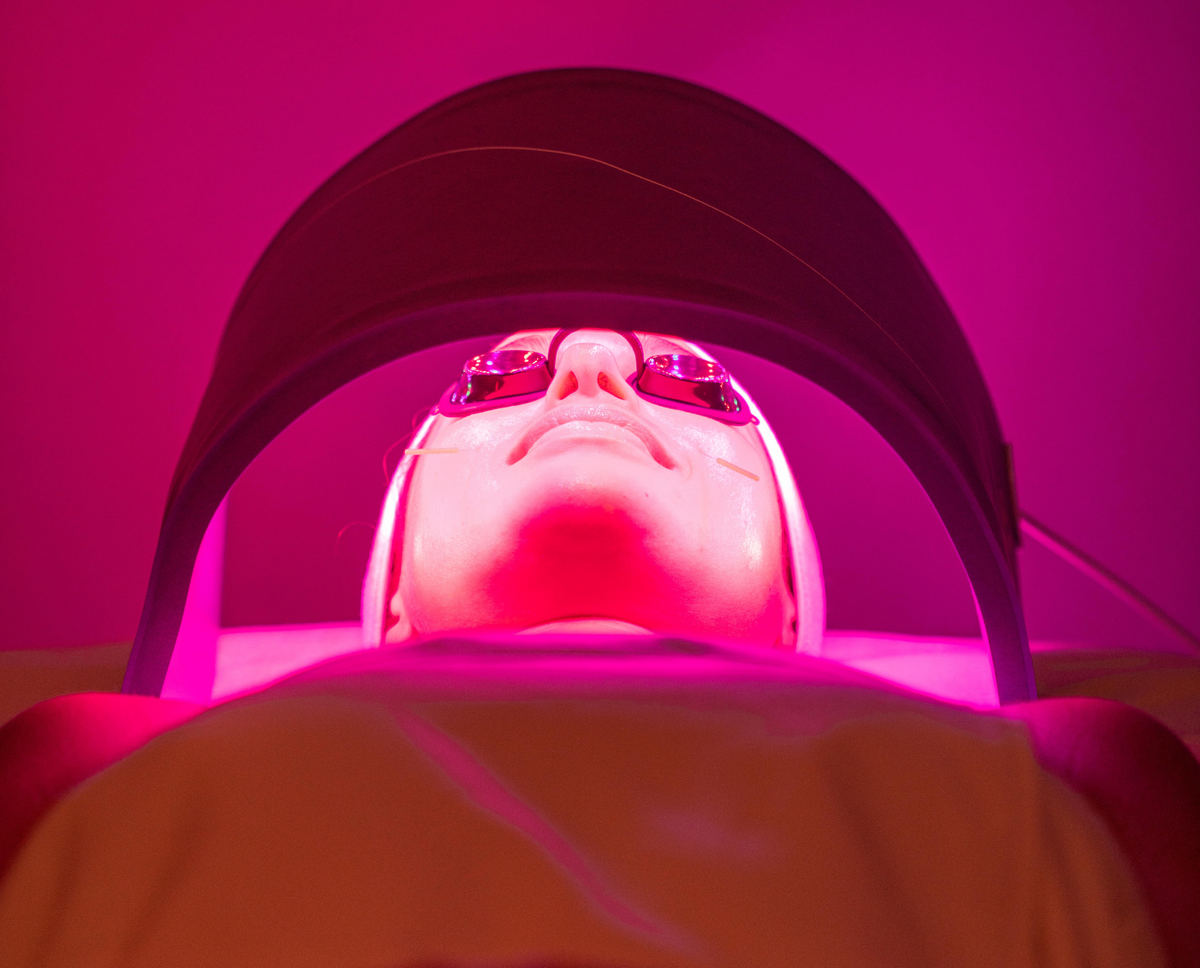 ORA Method™ Acupuncture Facial